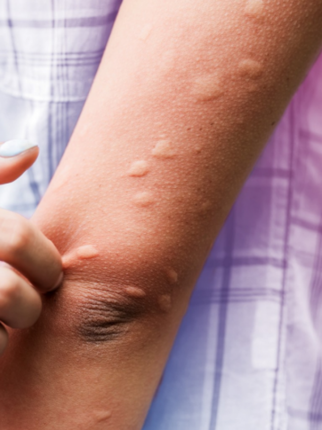 Equinácea: Fortalecendo suas Defesas Naturais - inspiração 2