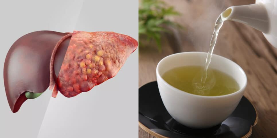 Cardo Mariano: o protetor hepático que você precisa conhecer - inspiração 2