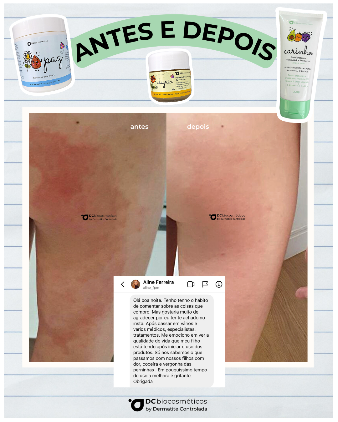 Equinácea: Fortaleça Sua Pele de Forma Natural - inspiração 1