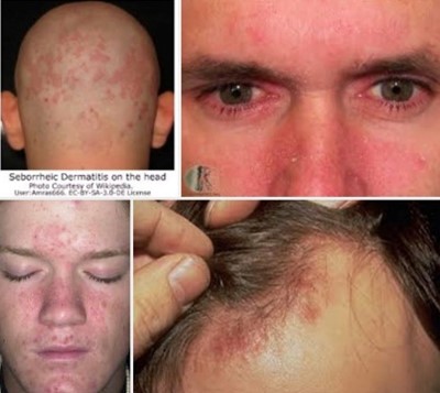 Calêndula: Cicatrização e Suavidade em Cada Gole - inspiração 2