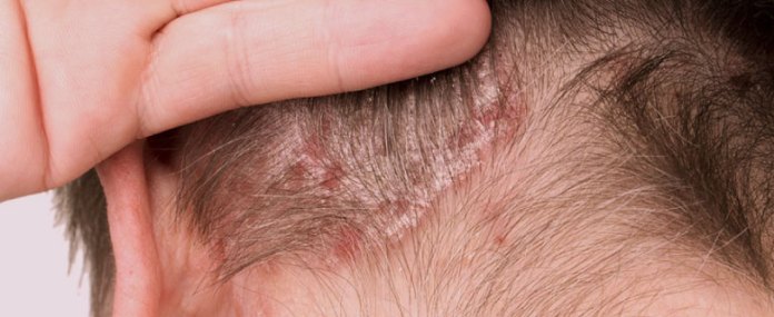 Erva-cidreira: Relaxamento que Reflete na Pele - inspiração 2