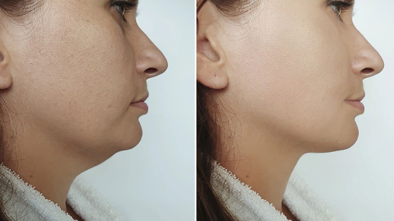 Chá de Cavalinha: Poder Drenante Concentrado - inspiração 2