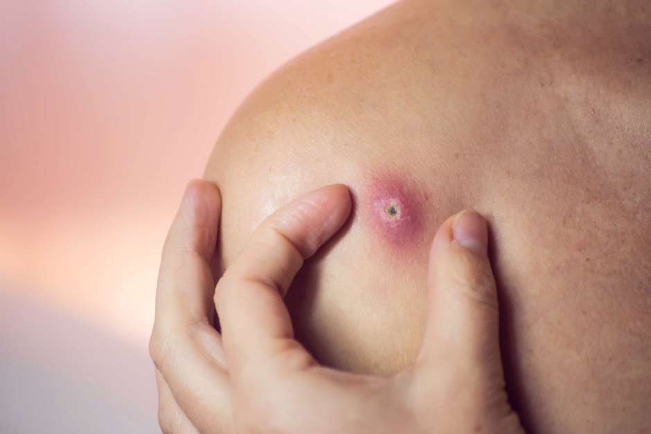 Camomila: A Aliada Suave para Acalmar a Pele Irritada - inspiração 2