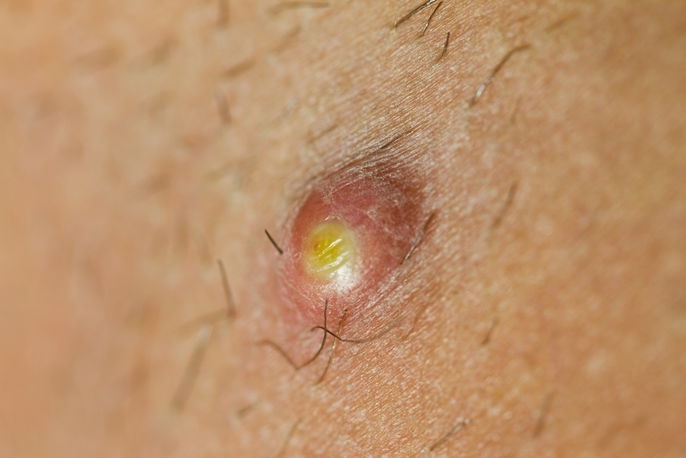 Alho: O Antisséptico Natural Poderoso - inspiração 2