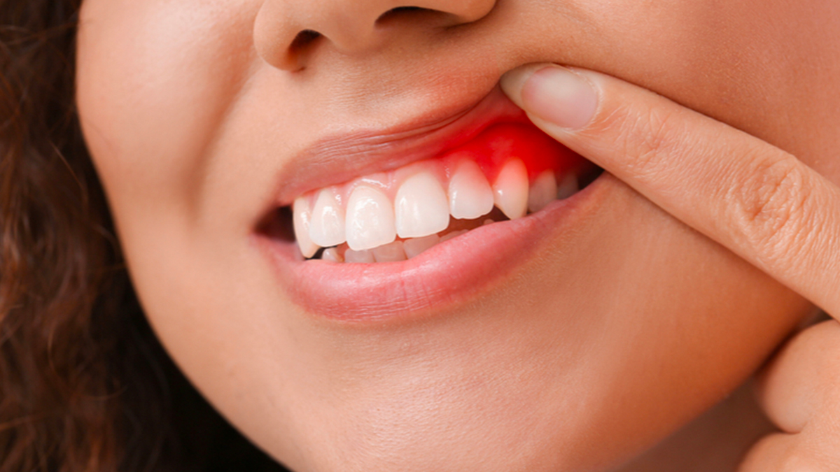 Cravo: Potência Antisséptica Natural - inspiração 2