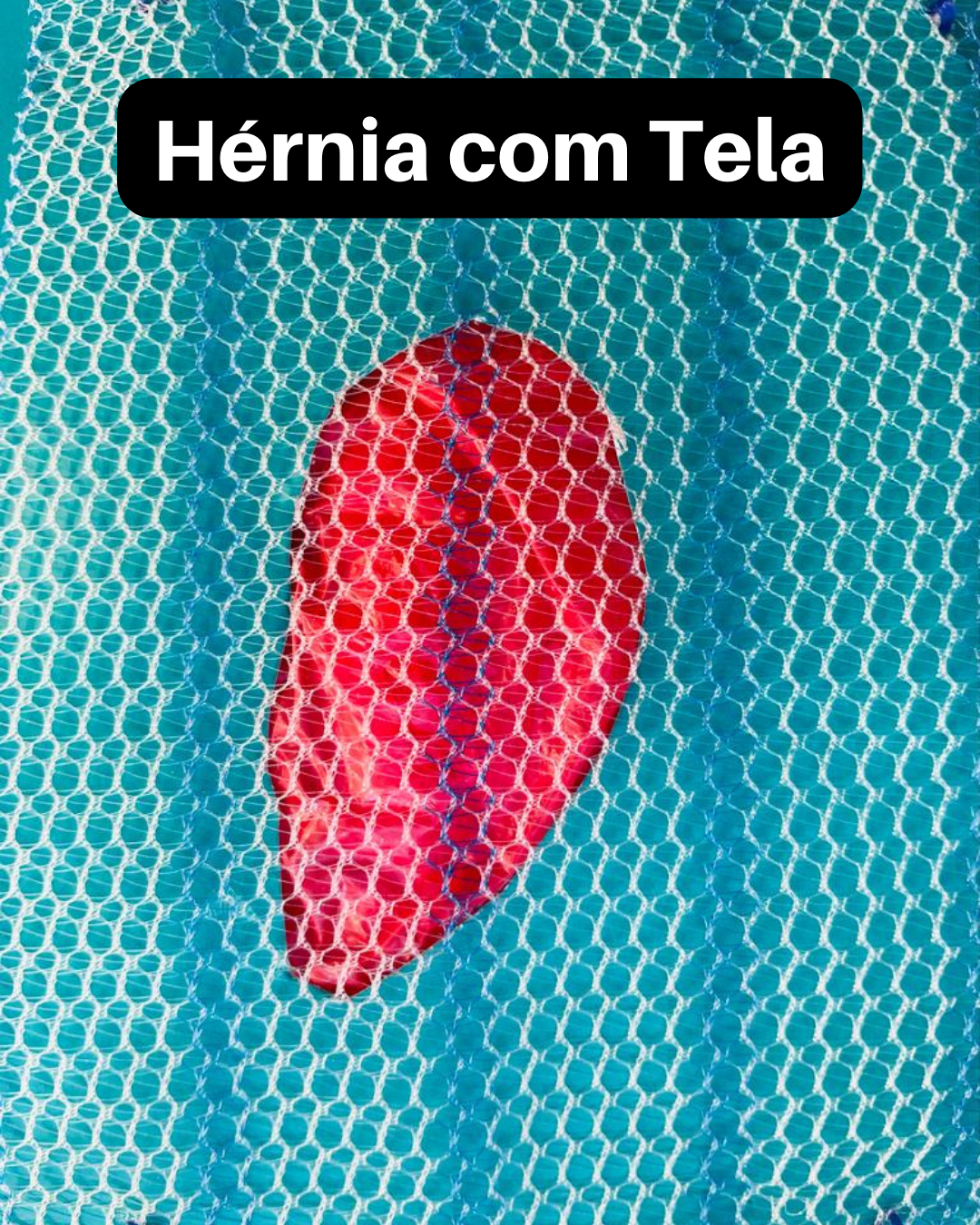 Como fortalecer a região abdominal de forma segura e eficaz. - inspiração 1