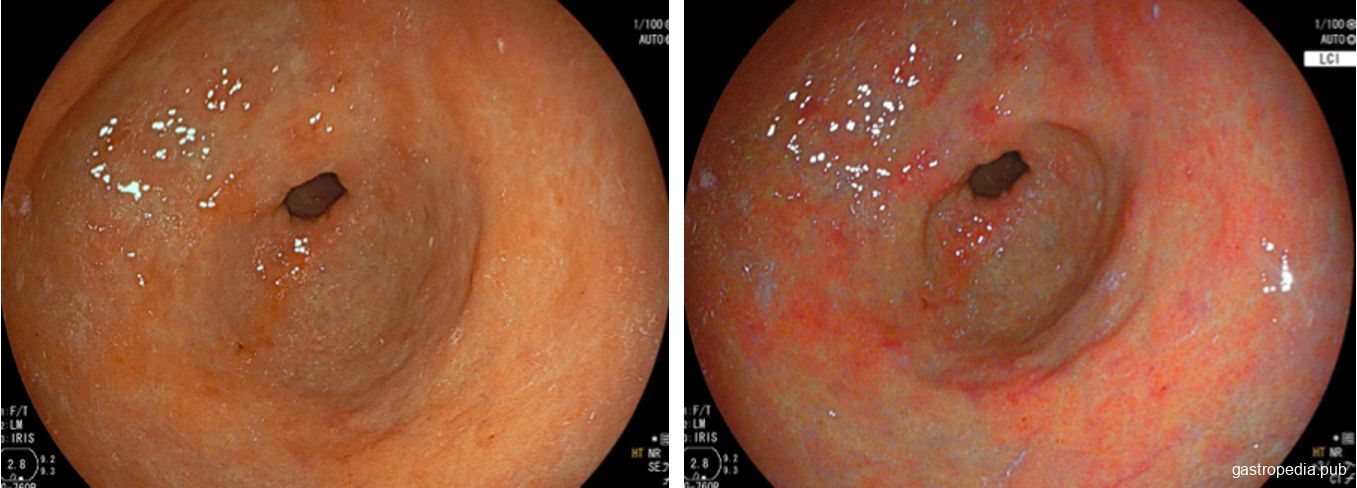 Hortelã: Alívio e Conforto Para o Seu Digestivo - inspiração 1