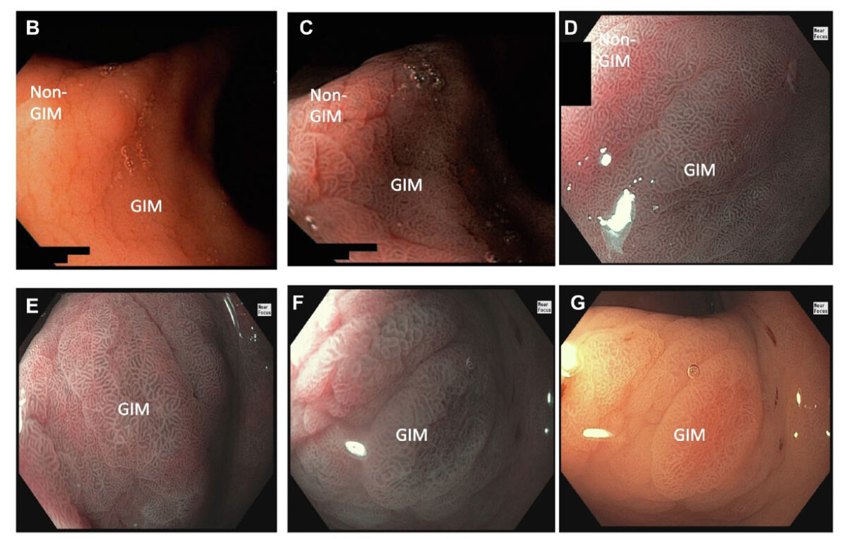 Gengibre: Ação Reparadora e Digestiva - inspiração 2