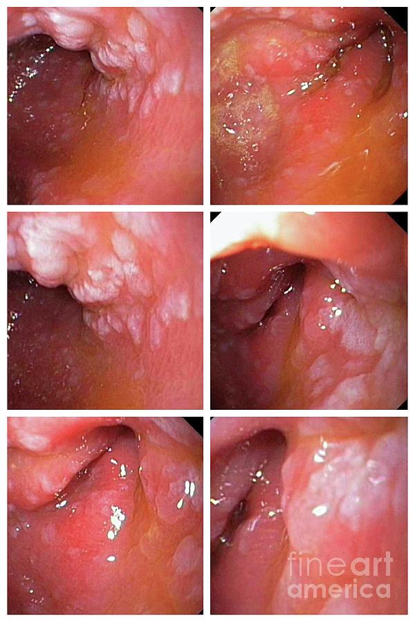 Boldo: Desintoxicação e Bem-Estar Hepático - inspiração 1