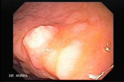 Boldo: Desintoxicação e Bem-Estar Hepático - inspiração 2