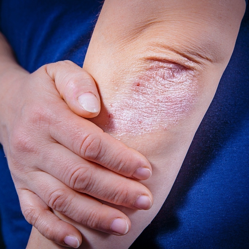 Erva-cidreira: Propriedades Calmantes e Anti-inflamatórias - inspiração 1