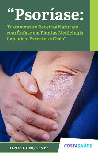 Urtiga: Um Diurético Natural com Benefícios - inspiração 2