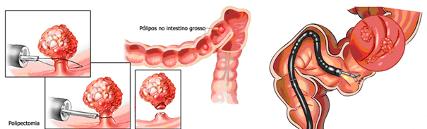 Atenção à qualidade: Escolha ervas confiáveis - inspiração 1