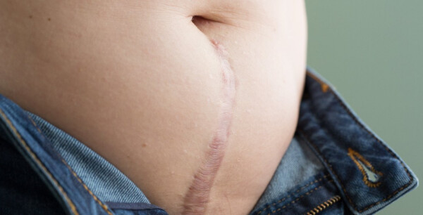 Ervas adaptógenas: equilibrando seu sistema naturalmente - inspiração 1