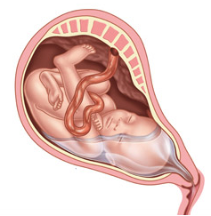 Acupuntura e Acupressão como Estímulos - inspiração 1