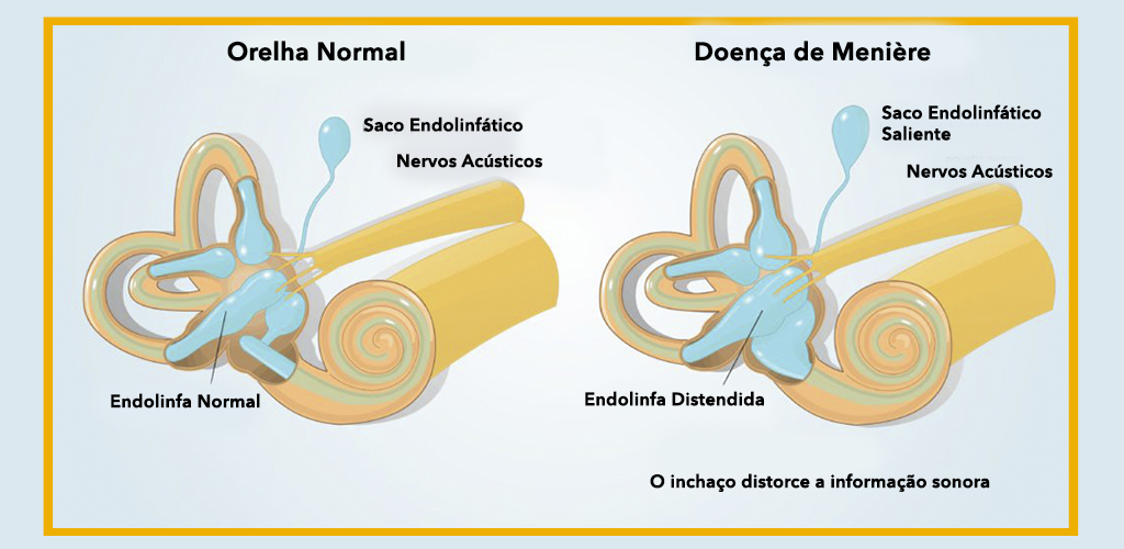 Hortelã: Alívio Digestivo e Sensação de Leveza - inspiração 1