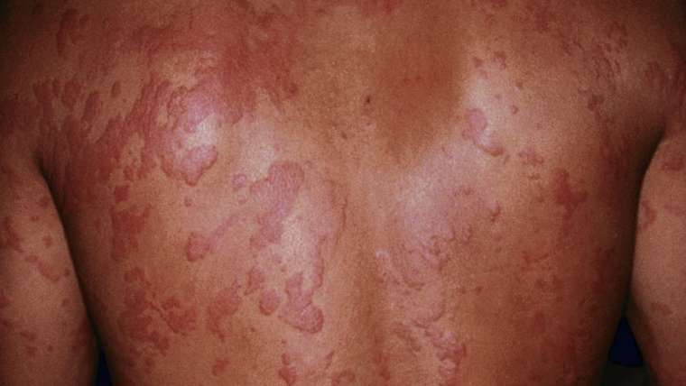 Camomila: O Clássico Calmante Para Sua Pele - inspiração 2