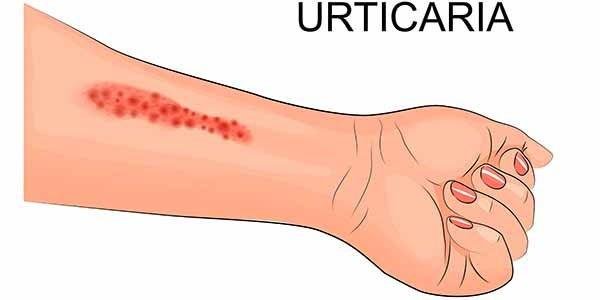 Capim-Limão: Um Toque Cítrico Para Acalmar a Pele - inspiração 1