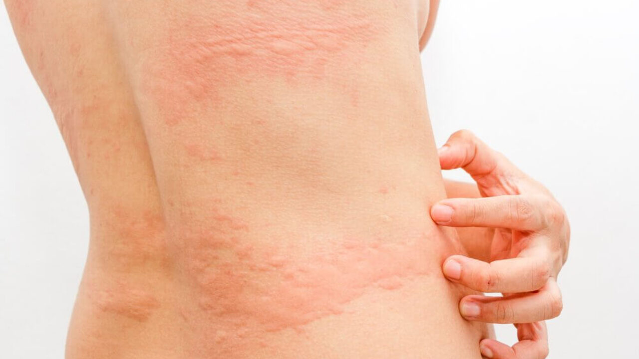 Erva-Cidreira: Tranquilidade Para Sua Pele Irritada - inspiração 2