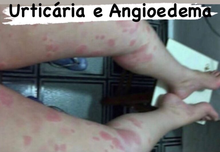 Calêndula: Cicatrização e Alívio das Manchas Vermelhas - inspiração 2