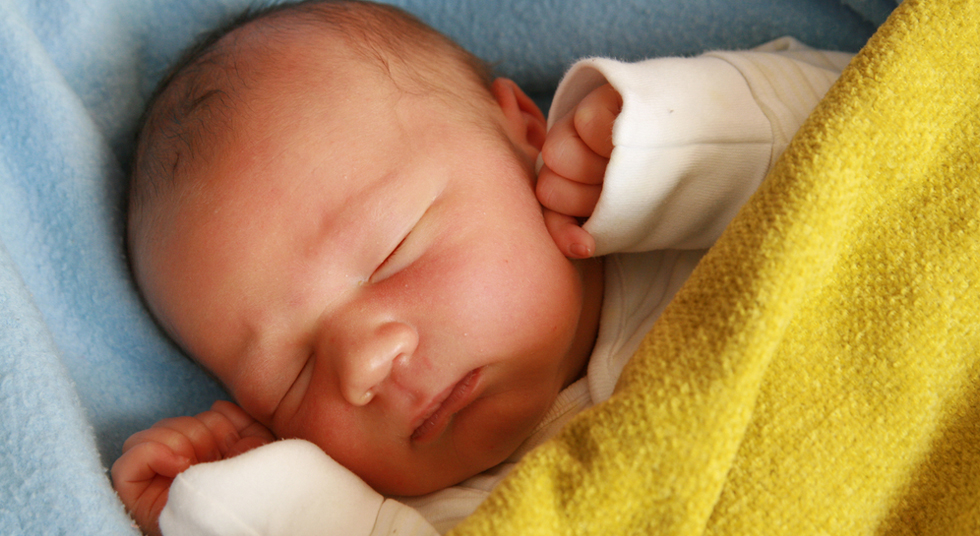 Sinais de alerta da icterícia em recém-nascidos que exigem atenção médica imediata
