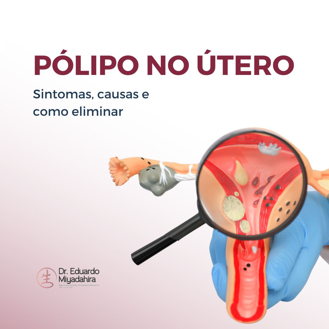 Histeroscopia Cirúrgica: O que é