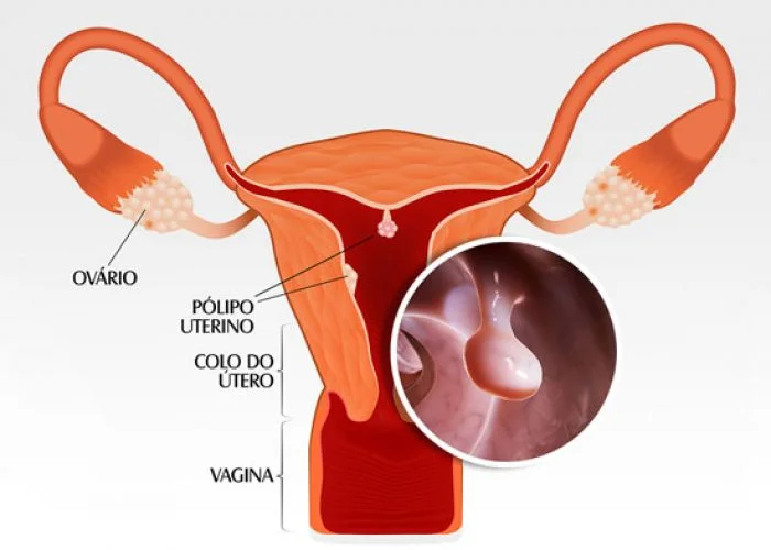 como funciona e recuperação